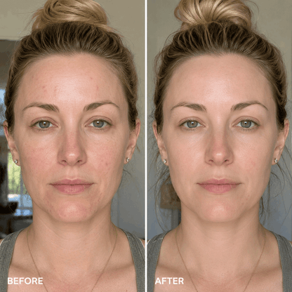 Before and after comparison of a woman's face with a neutral background
